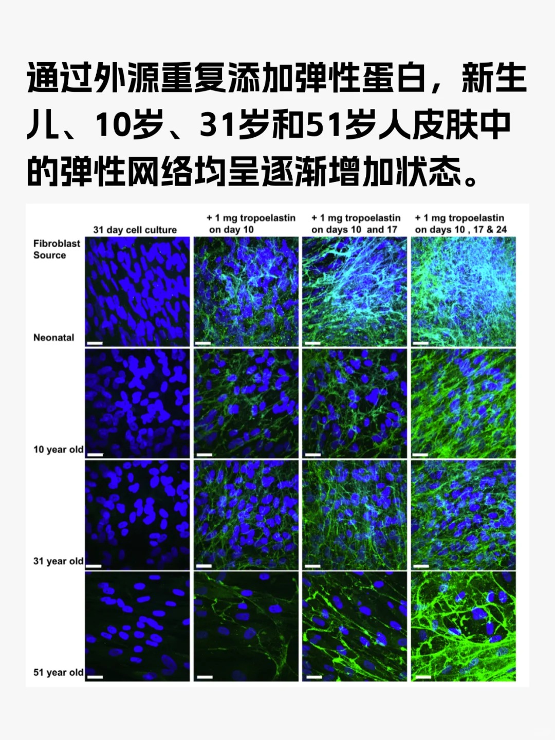抗老成分：弹性蛋白，有效抗老真护法！_重组胶原蛋白